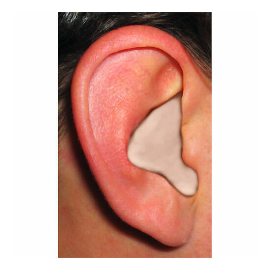 Radians CEP001 Custom Molded Easy Fit Ear Plugs 10 Minute *Free US Shipping image {2}